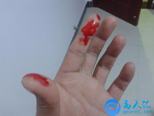 梦见自己流血是什么意思?梦见自己流了很多血好吗? 周公解梦