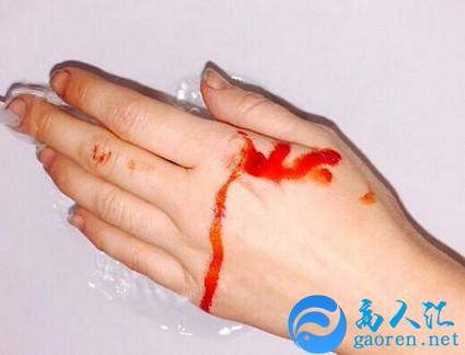 周公解梦:梦见别人流血是什么预兆 周公解梦