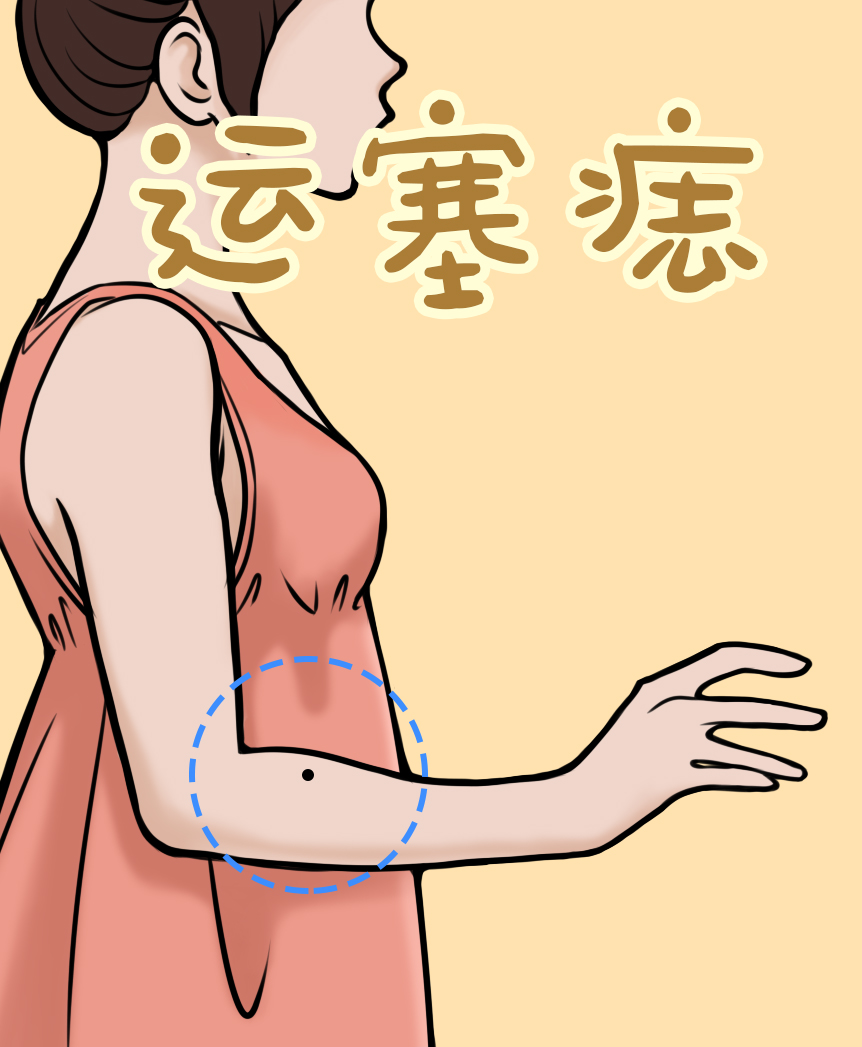 图解」手臂上什么痣相财运好？什么痣相易多情？
