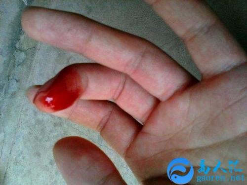 梦见手流血是什么意思?有什么预兆?