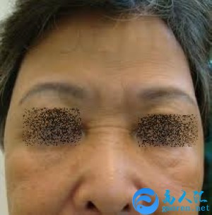 什么是山根山根面相解读