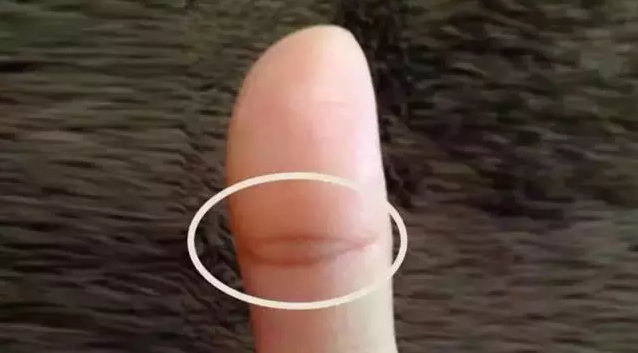 大拇指上有这个纹路的人不简单,男娶富妻女嫁贵夫!