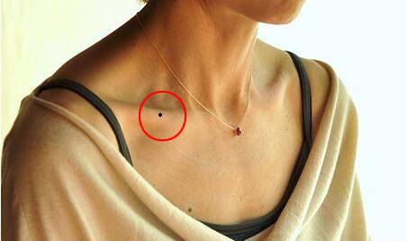 这三种痣相的人能嫁贵夫都是好运痣